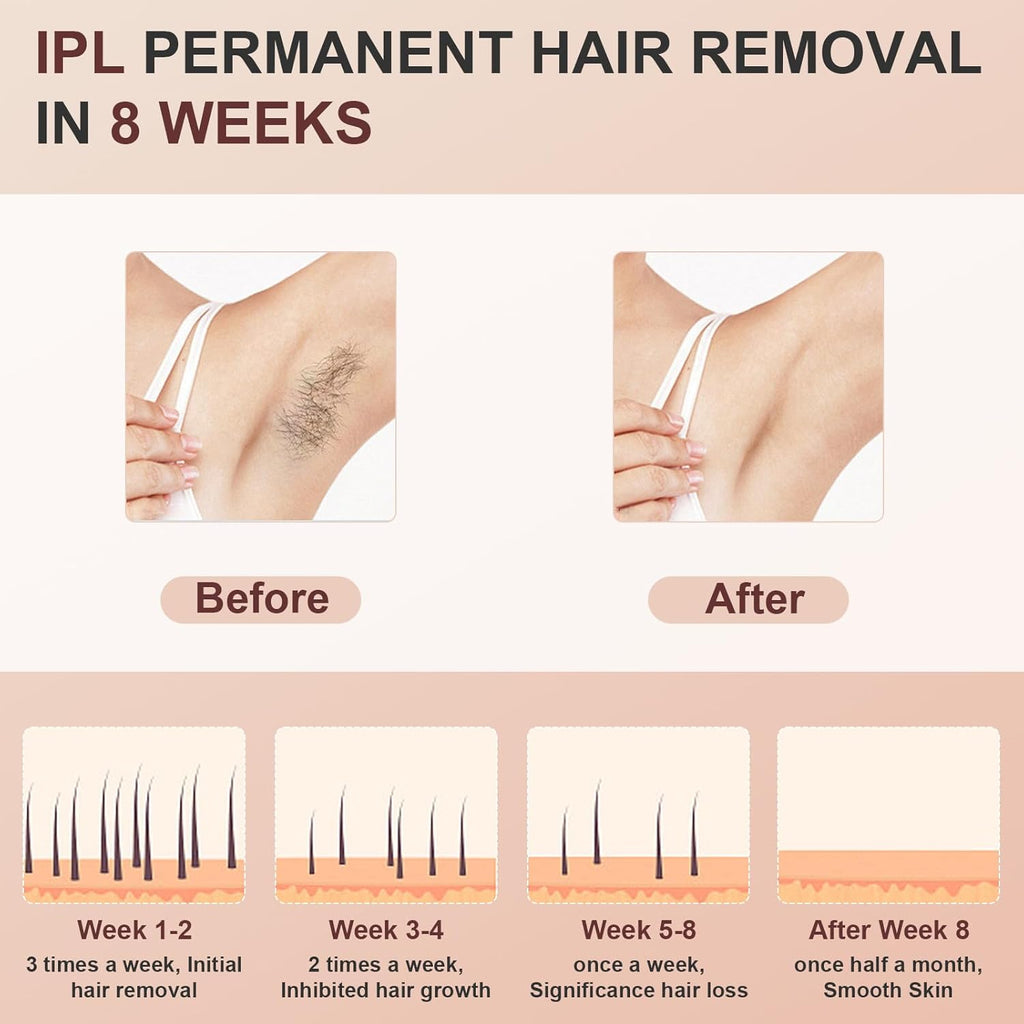 999900 Flashes IPL Hair Removal Device with Cooling System P687